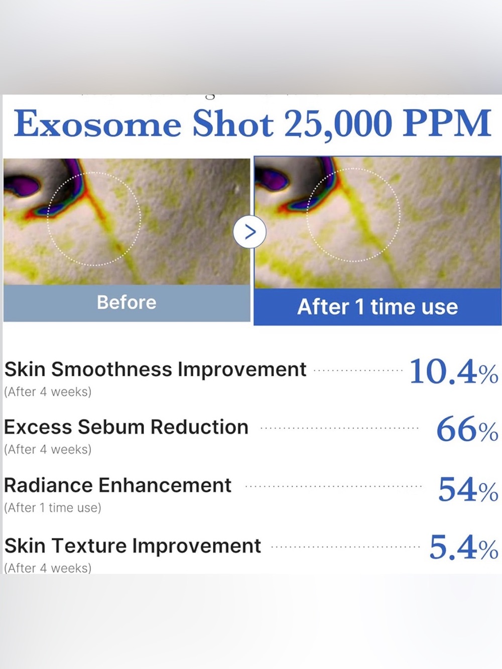Medicube One Day Exosome Shot 25000 (B2) - Picture 8 of 10